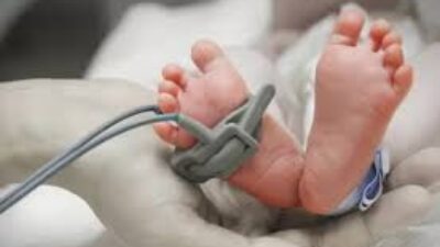 Bayi Asal Brazil Jadi Sorotan Karena Punya 4 Ginjal